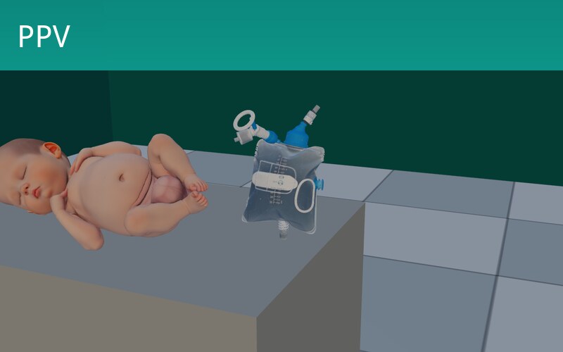 Bag-Mask Ventilation (PPV) — BLS Drill